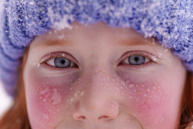 Close-up of a child's face with blue eyes and rosy cheeks, wearing a blue knit hat dusted with snowflakes. The child's skin is slightly freckled and has tiny droplets of melted snow, capturing a wintery atmosphere.